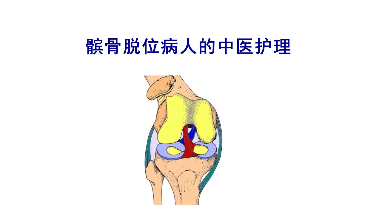 髌骨脱位病人的中医护理D304-白衣资料网
