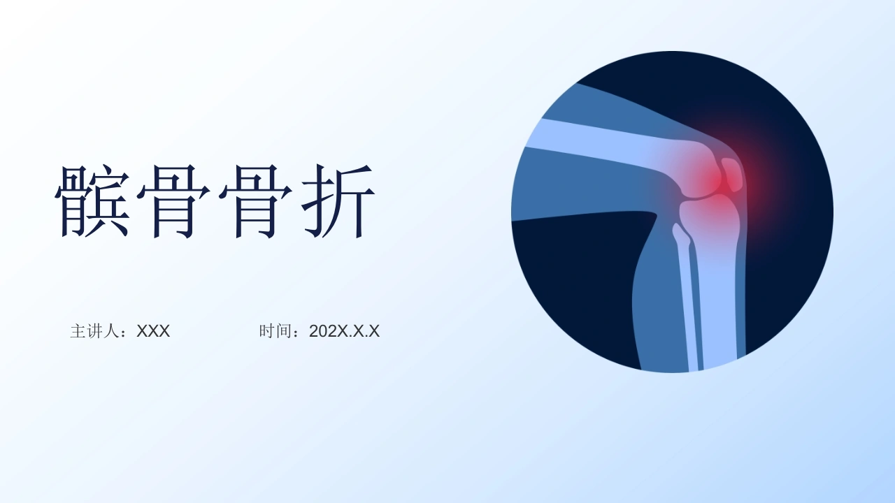 髌骨骨折相关知识C305-白衣资料网